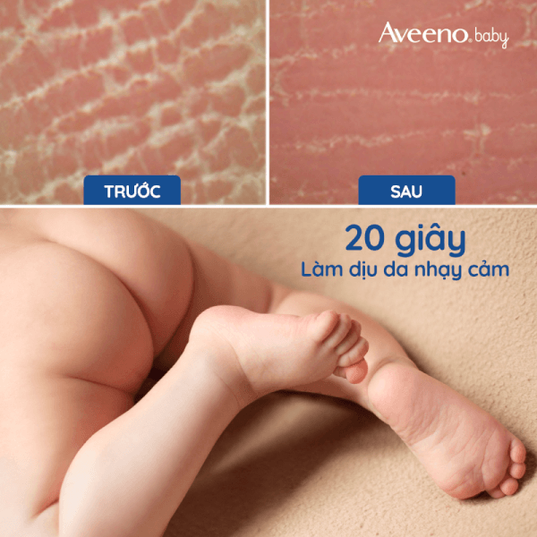 Sữa dưỡng thể dành cho bé Aveeno Baby da thường 227g